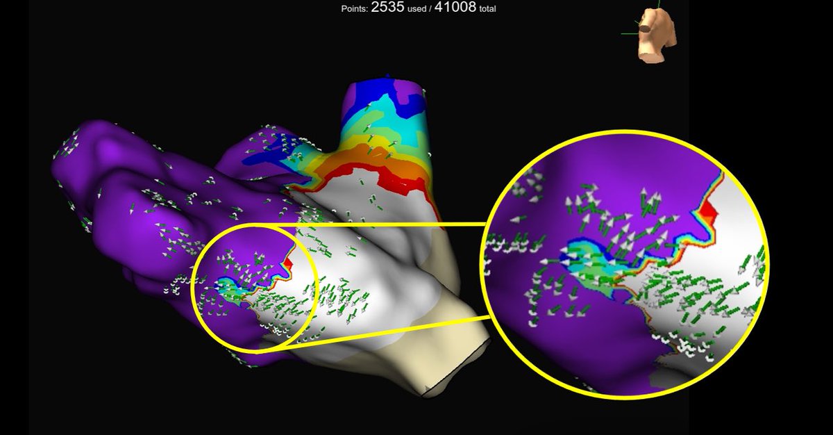 Corbyn Fulmer tweet media