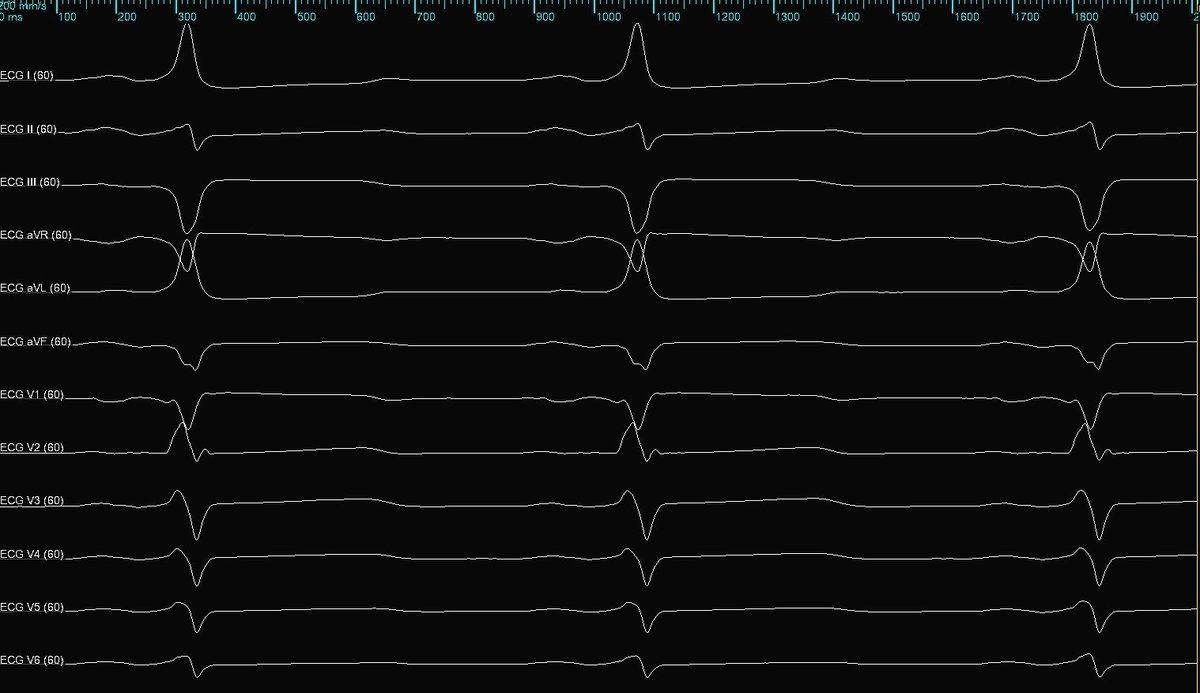 Corbyn Fulmer tweet media