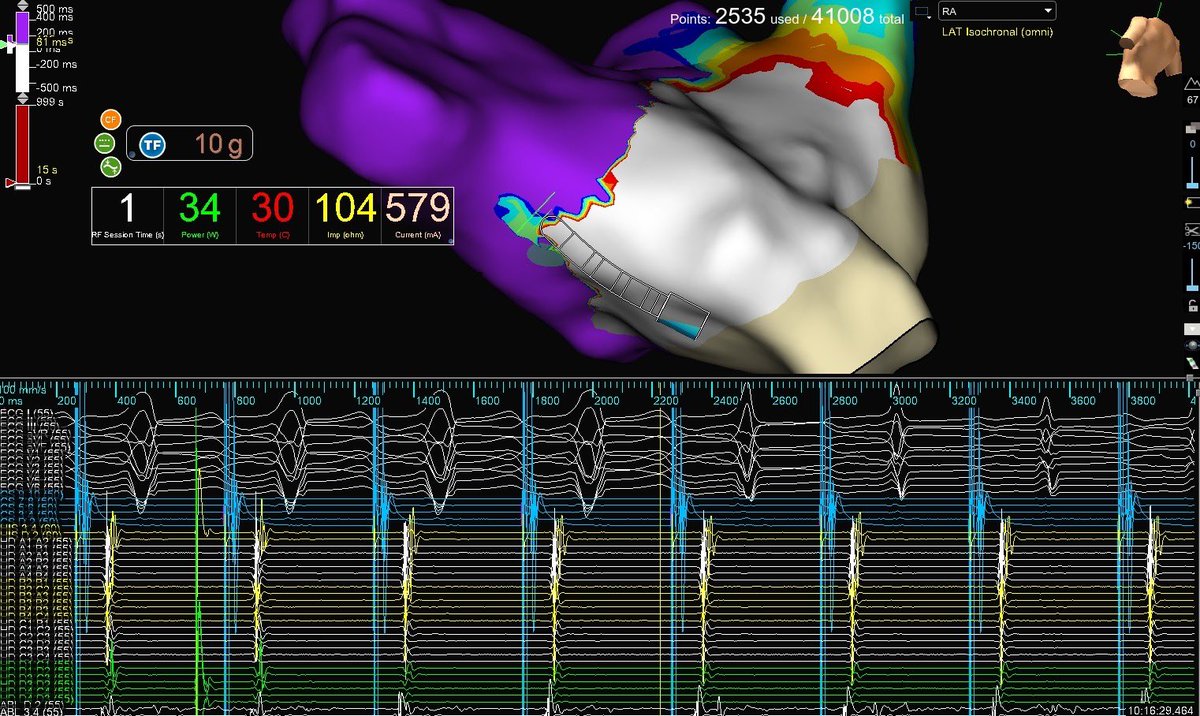 Corbyn Fulmer tweet media
