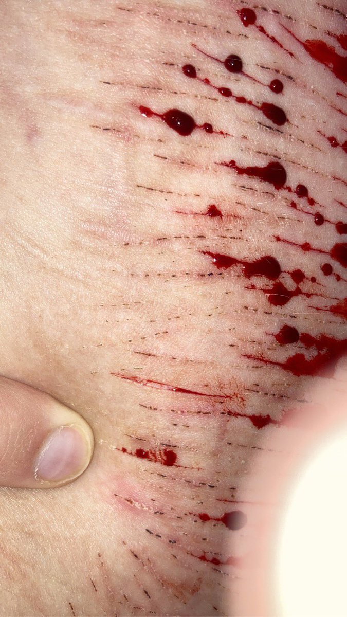 imhisbfbitch's tweet photo. i almost died making these styros cause i lost too much blood, oops 

fake! /j tw sh!

styrotwt shtwt bloodtwt raspberryfillingtwt 988twt https://t.co/VsvOg4HPoL