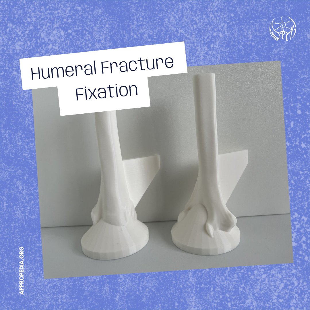 This module allows medical staff who are not orthopedic specialists to become confident &amp; competent in irrigation &amp; debridement as part of external fixation procedures for open humeral shaft fractures performed in regions without specialist coverage.

💻appropedia.org/Humeral_Fractu…