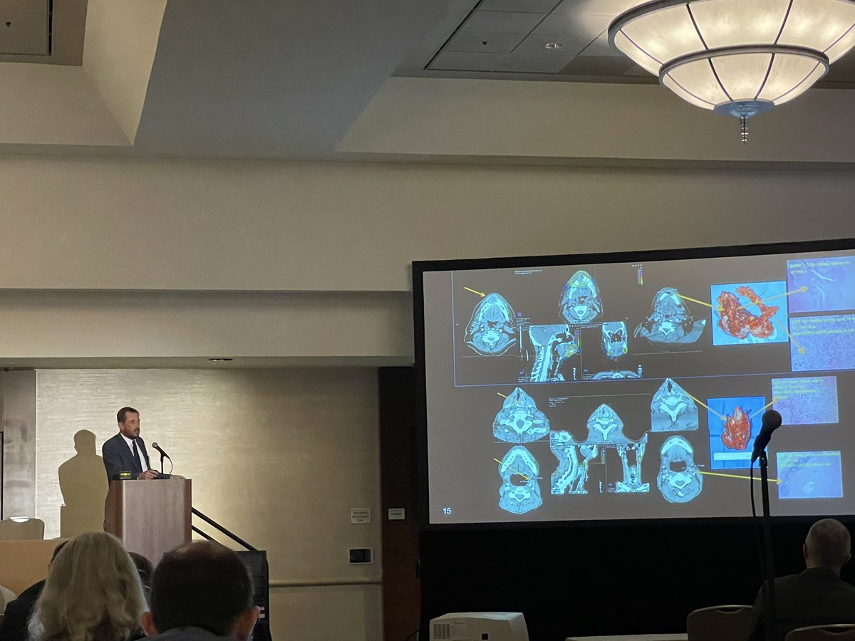 PatelMDDDS's tweet photo. Great way to kick off the 5th multiD H+N /New Horizons in immunotherapy meeting. Thanks to @UCSDHealth @DrEzraCohen @rbryanbell @RobertFerrisMD for organizing all the thought leaders in this space in beautiful San Diego. #finishcancer @ProvHealth https://t.co/QLXUSe6PAB