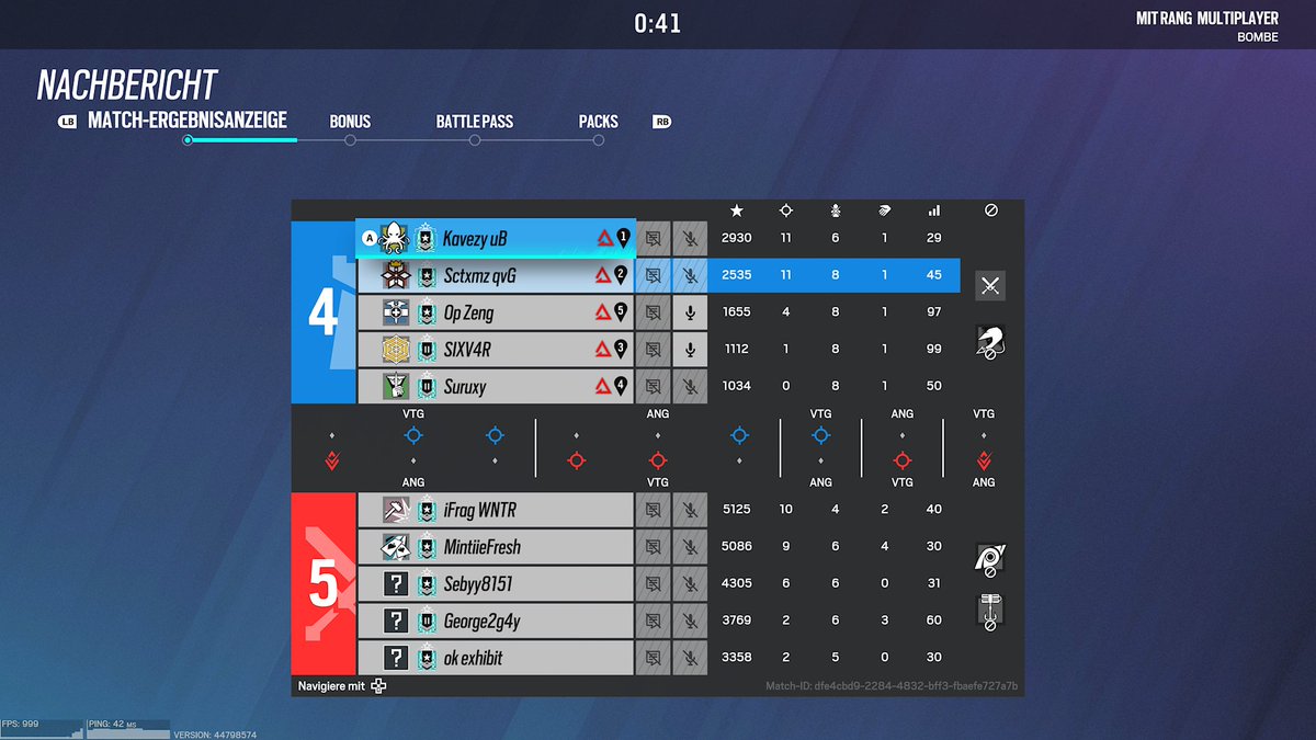 GG <a href="/Suruxyy/">Suruxy</a> nächstes mal spiel bitte nicht mit deinen Füßen