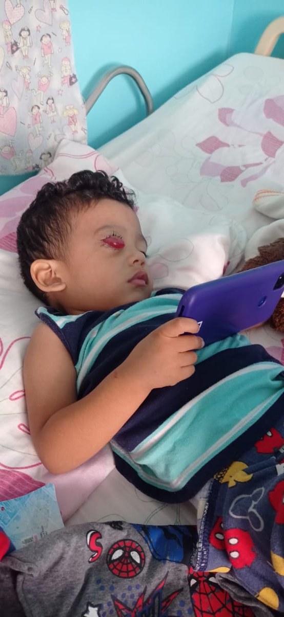Israel de 2 años acaba de empezar quimioterapia por un retinoblastoma, necesita urgente RNM y gammagrama óseo, ya tengo el presupuesto, en total son $725, solo tenemos $90. Ese tumor crece rápidamente, mientras más rápido hagamos esto, más probabilidades de vencer al cáncer 🙏🙏