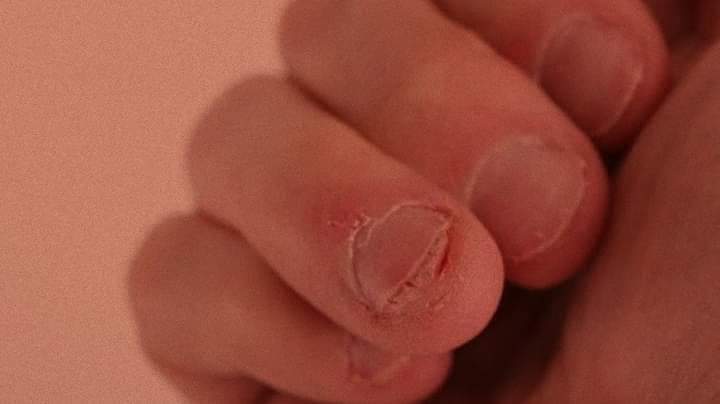 kveira13's tweet photo. Quando o coração fecha, o corpo fala https://t.co/TBApynxZIX