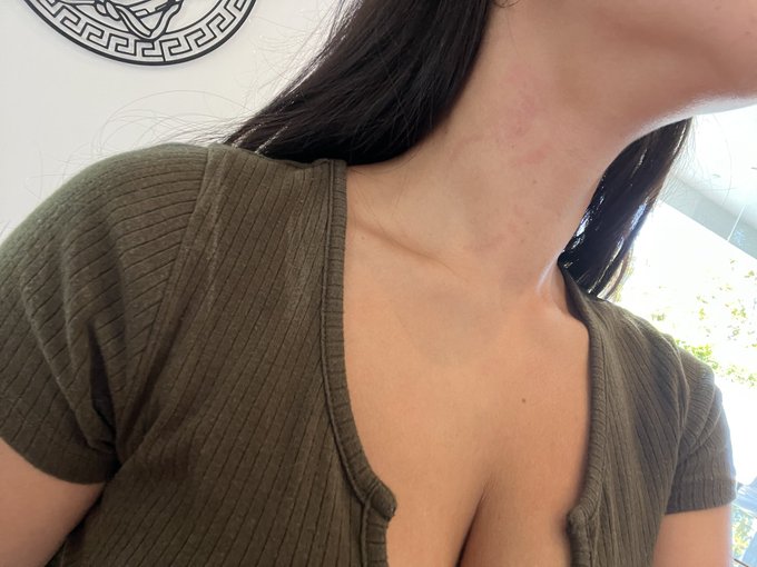 @KeiranLee marking his territory. You can literally see individual teeth marks ? https://t.co/8x1hyx