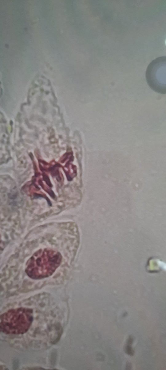 CiliateGal's tweet photo. #mitosis #celldivision #metaphase #anaphase first year #biology labs #science #teaching #microscopy https://t.co/2oiI54G2u4