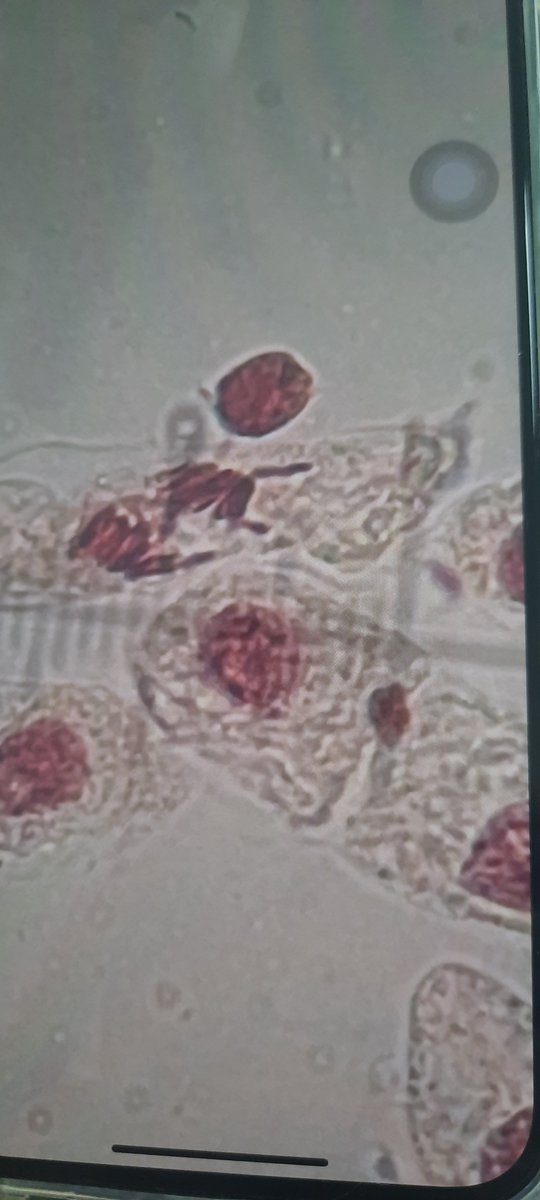 CiliateGal's tweet photo. #mitosis #celldivision #metaphase #anaphase first year #biology labs #science #teaching #microscopy https://t.co/2oiI54G2u4