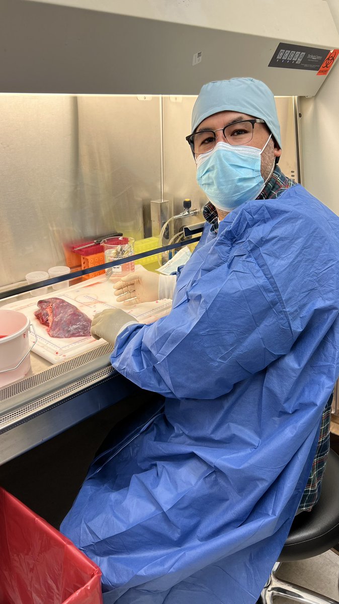 Melanie Königshoff (@m_konigshoff) on Twitter photo What a milestone! Congratulations to Ricardo for processing his 100th human lung today🎉 and a big Thank you to ALL from <a href="/Eickelberg_MD/">Oliver</a> & #PinkLab <a href="/JohnSembrat/">John Sembrat</a> This is amazing teamwork 🙏 #ScienceRocks #WeLovePCLS <a href="/TriStateSenNet/">TriState SenNet TMC</a> <a href="/ThreeLakes_TLF/">Three Lakes Foundation</a> <a href="/PACCM/">PACCM</a> What a milestone! Congratulations to Ricardo for processing his 100th human lung today🎉 and a big Thank you to ALL from <a href="/Eickelberg_MD/">Oliver</a> & #PinkLab <a href="/JohnSembrat/">John Sembrat</a> This is amazing teamwork 🙏 #ScienceRocks #WeLovePCLS <a href="/TriStateSenNet/">TriState SenNet TMC</a> <a href="/ThreeLakes_TLF/">Three Lakes Foundation</a> <a href="/PACCM/">PACCM</a>