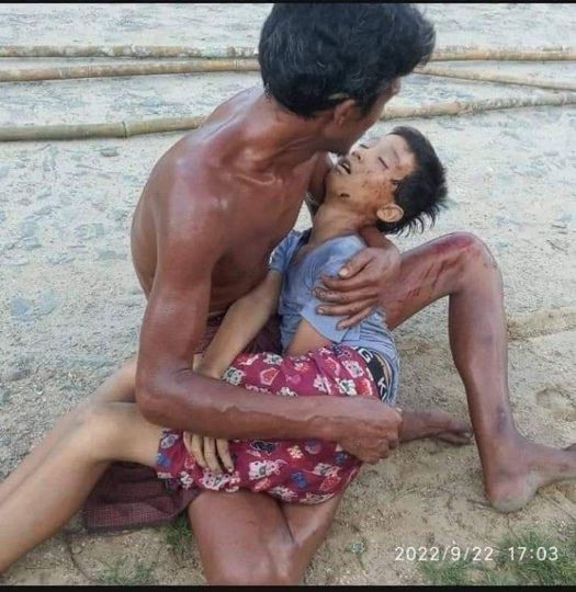 Mg Zwe Naing Win, 12, was killed and other villagers wounded when regime forces shelled two villages in Shwegu Township, Kachin State on Thursday, the Kachin Waves media outlet said. Residents fled their homes due to the attacks. (Photo: Kachin Waves) #WhatsHappeningInMyanmar