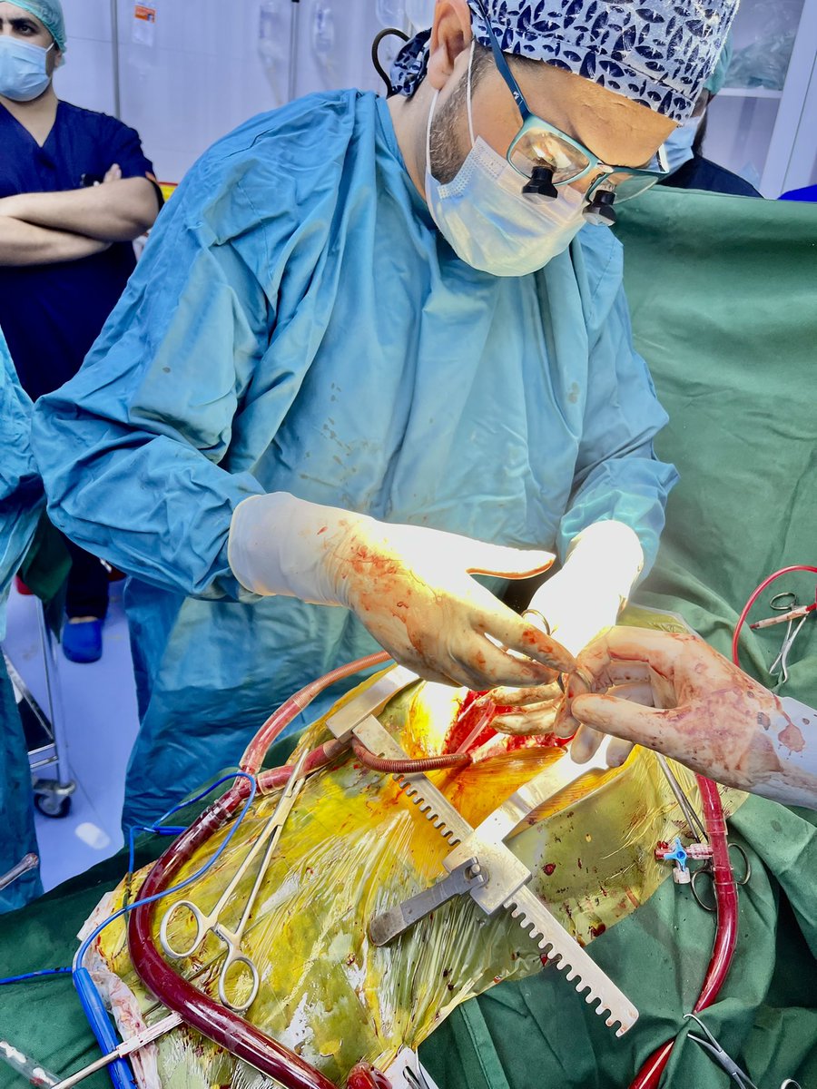 mRafiHamidi's tweet photo. My first successful, Mitral Valve Intervention.  🤪

When you do things from your soul, you feel a river moving in you and you feel joy. ~Rumi

This is #Kabul, #Afghanistan. https://t.co/6TRkwl36xh