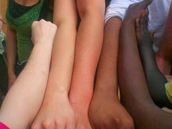 Say no to racism
Embrace love we all are  one body and one flesh colour doesn't matter