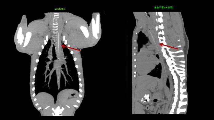 MinfoundMedical's tweet photo. Answer will be revealed soon... https://t.co/0zPUHfxXS3