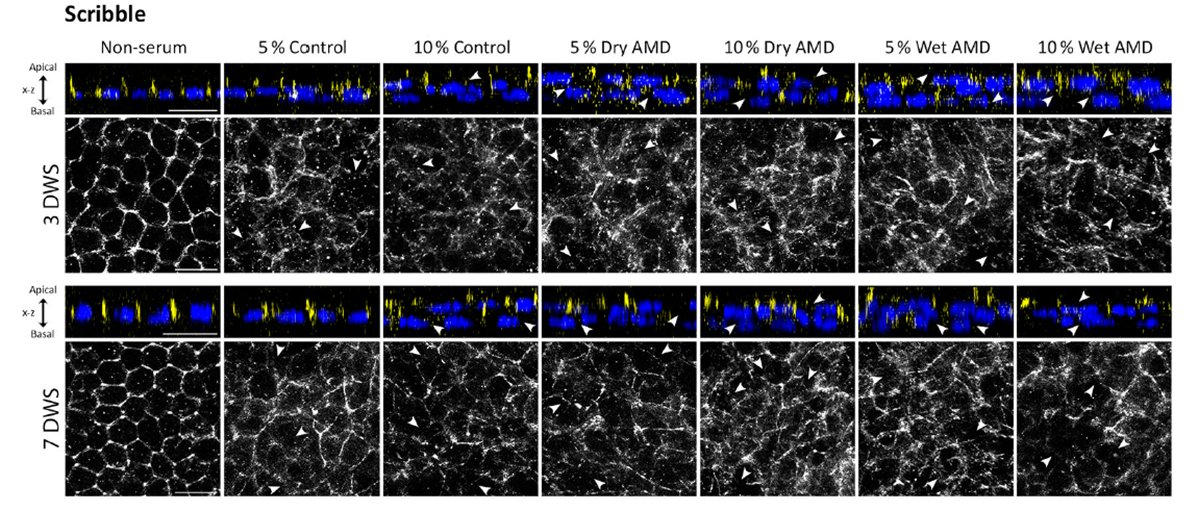 ConchiLillo's tweet photo. Feliz de compartir por aquí el último trabajo publicado en #FrontiersInNeuroanatomy @FrontiersIn. Bravo @AliciaSegurado et al!😉🎉 @Incyl_Usal @SENC_ 
Scribble basal polarity acquisition in RPE cells and its mislocalization in a pathological AMD-like model https://t.co/wdzlTzLuA0 https://t.co/uiCyb3evdG