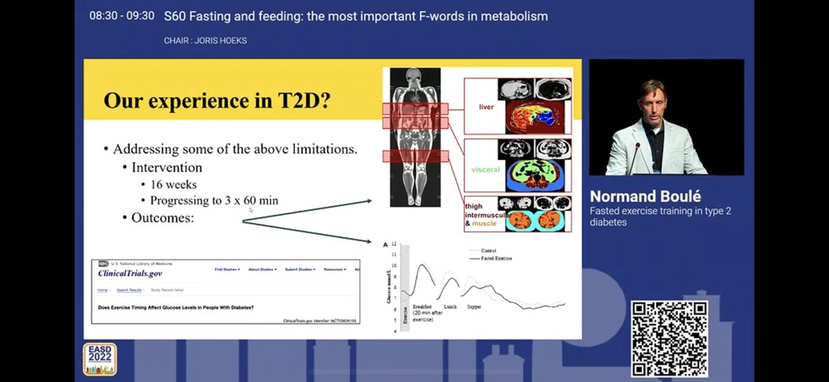 YepezDra's tweet photo. Dr. Boulé: Fasted vs fed exercise seems better, with a bit different response in T2D #EASD2022 https://t.co/KDPiR4hJhY