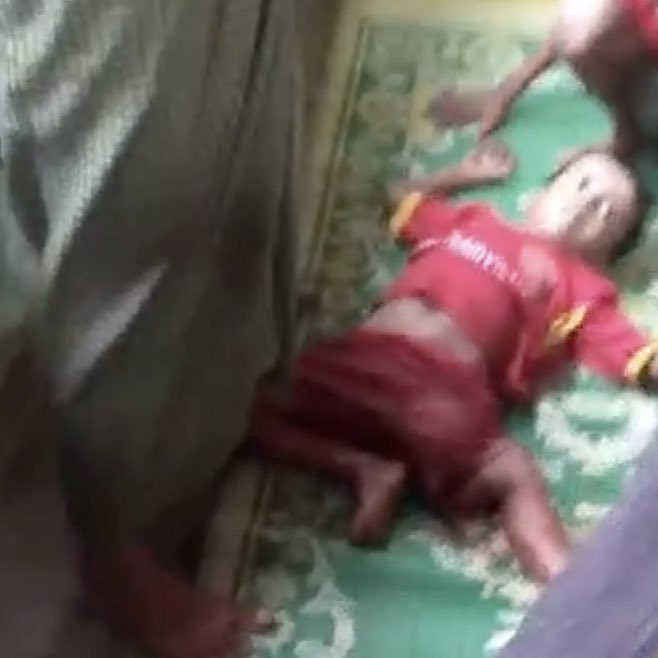 A Rohingya man &amp; a woman from Tha Baik Taung, Buthidaung, were injured by the artillery shells fired by #MyanmarMilitaryTerrorists this morning. Again this afternoon, a Rohingya child &amp; older woman from Atwin Nget Thay were wounded by artillery shells fired by the same terrorists