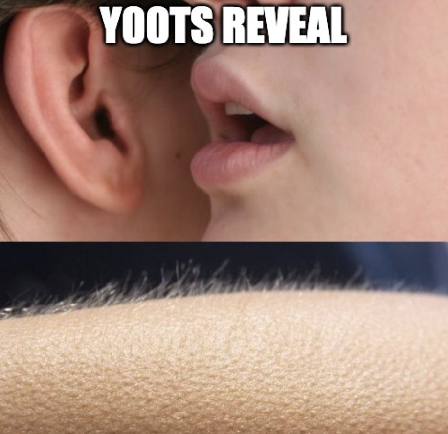 zkRemda's tweet photo. When someone talks about @y00tsNFT reveal. https://t.co/Fn8xAf8iLw