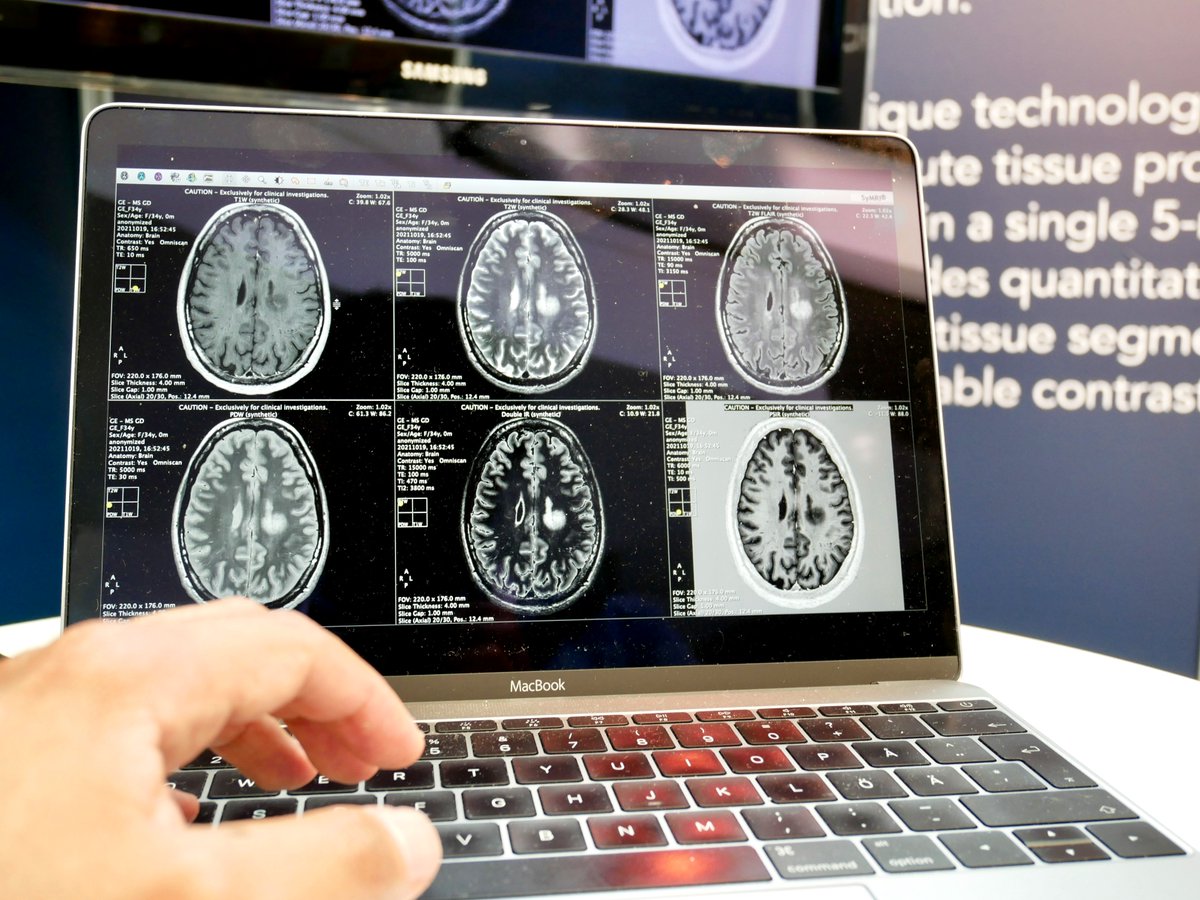 Synthetic_MR's tweet photo. We are #LIVE at the 78th Annual Meeting of the Korean Society of Radiology, KCR 2022, in Seoul, South Korea! π°π· @kcr4u
#kcr2022 #patientexperience #imaging #symri #mri #mrinetwork #neuroradiology #radiology #quantitativemri https://t.co/b0dKEj14TM
