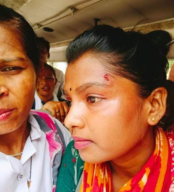 48 દિવસથી ગાંધીનગરમાં ગ્રેડ પે મુદ્દે લડતા મારા આરોગ્યકર્મીઓ પર પોલીસ નો હુમલો જેને હું સખત શબ્દોમાં વખોડી કાઢું છું . 
હું મારા આરોગ્ય કર્મચારીઓ સાથે છું લડેંગે જીતેંગે
#ये_घाव_हम_कभी_नहीं_भूलेंगे
#Grade_pay