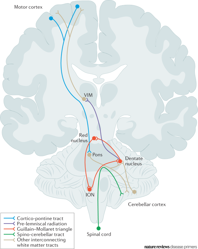 DiseasePrimers's tweet photo. The brain circuits involved in #essentialtremor pathophysiology can be conceptualized as four intersecting pathways within the cerebellar #cortex https://t.co/Q45PjGUcCh https://t.co/T7SzNvdHLC