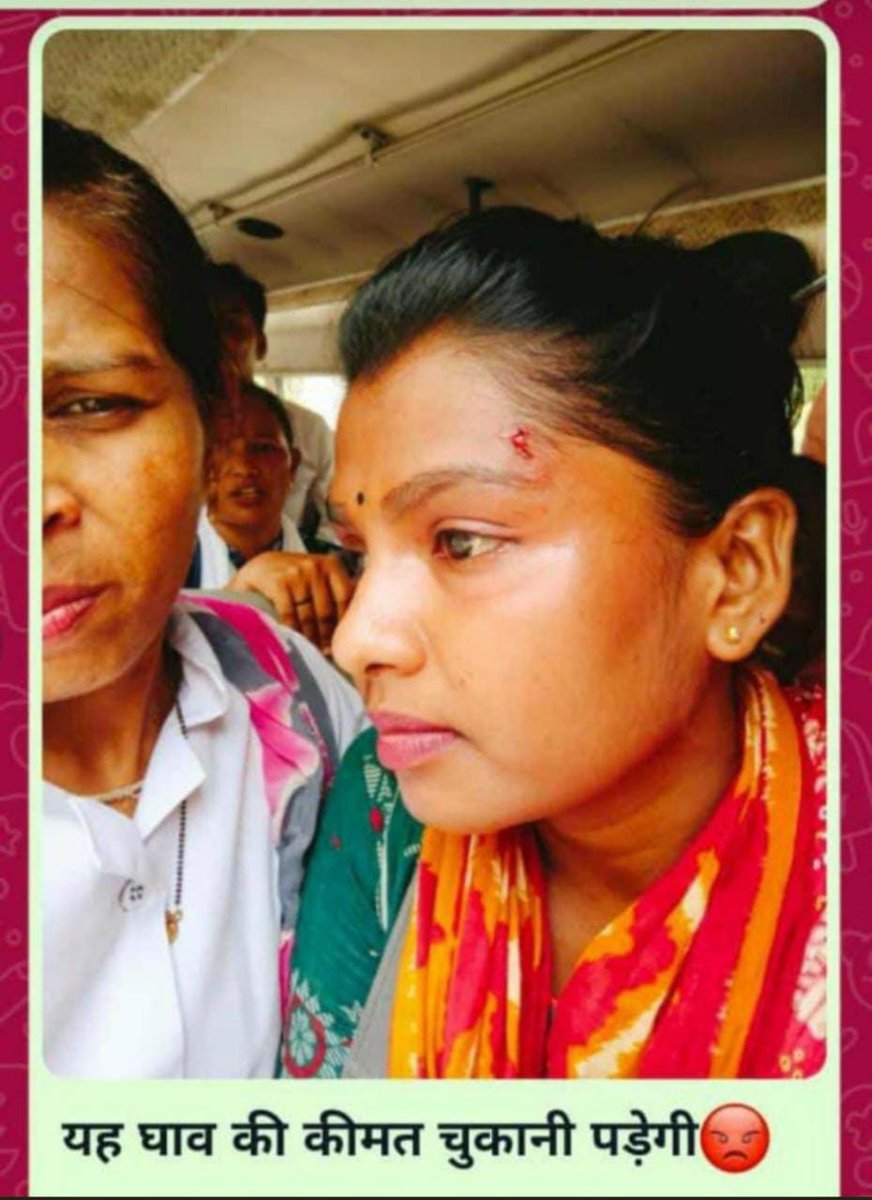 ગાંધી નાં ગુજરાત માં અહીંસા નાં માગૅ સત્યાગ્રહ કરી રહેલા આરોગ્ય કમૅચારીઓ ઉપર લાઠીચાર્જ...વાહ રે ગુજરાત સરકાર વાહ..#TechnicalCadreMphwFhw <a href="/abpasmitatv/">ABP Asmita</a> <a href="/aajtak/">AajTak</a> <a href="/ndtv/">NDTV</a> <a href="/jigneshmevani80/">Jignesh Mevani</a> <a href="/shaktisinhgohil/">Shaktisinh Gohil MP</a> <a href="/ZeeNewsIndiaNo1/">ZeeNews.India</a> <a href="/Zee24Kalak/">Zee 24 Kalak</a> <a href="/Gopal_Italia/">Gopal Italia</a> <a href="/ArvindKejriwal/">Arvind Kejriwal</a>