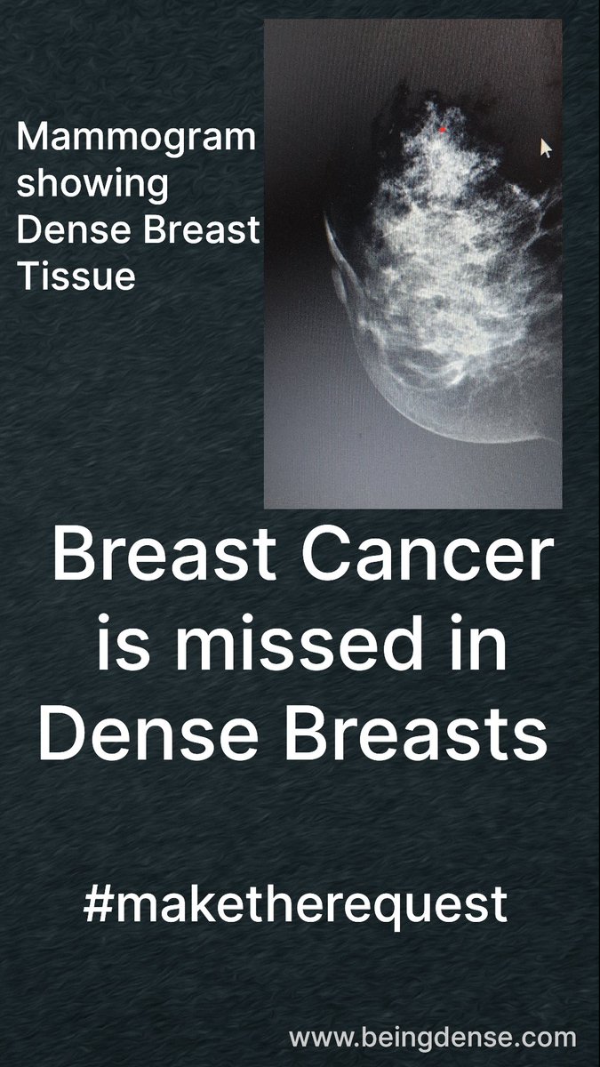 BreastDense's tweet photo. Updated European Breast Cancer Guidelines Development Group #ECIBC June 2022
"It might be important to speak with your health care professionals to determine if you have dense breast tissue and what it means for you"
🚩🚩🚩Get a Mammogram and #maketherequest https://t.co/DJADW5IGJZ