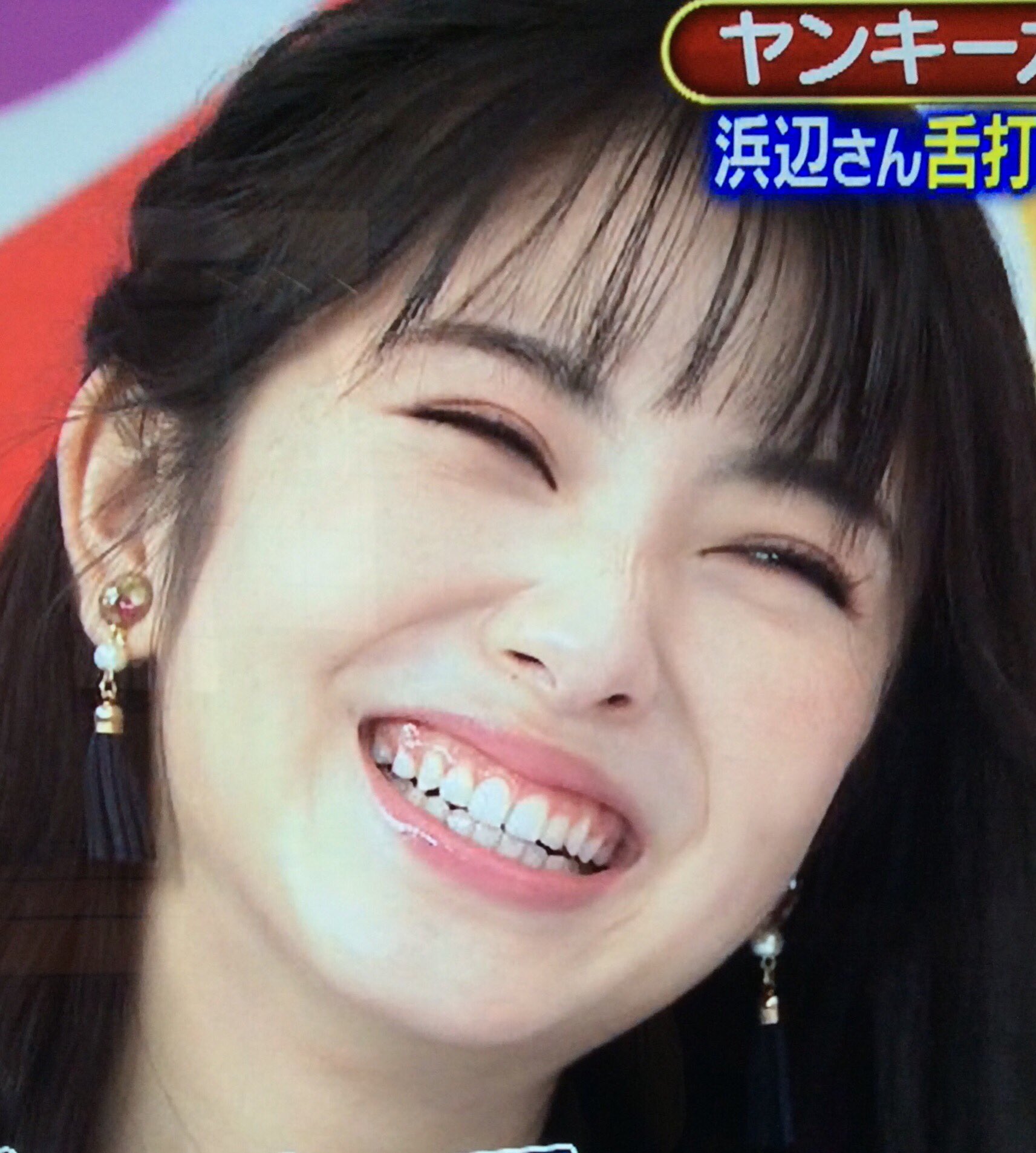 浜辺 美波 歯並び