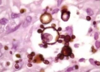 Mayo Clinic Infectious Diseases tweet media