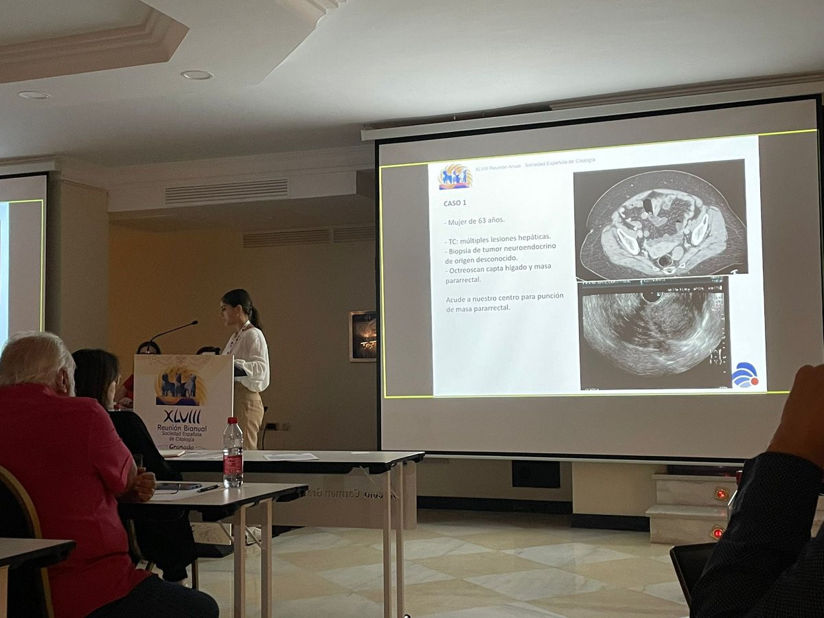 RyCPatologia's tweet photo. Nuestros residentes Natalia Cadavid y @dibuenopath en #SEC2022G @SECitologia https://t.co/tEueSVQ0kp