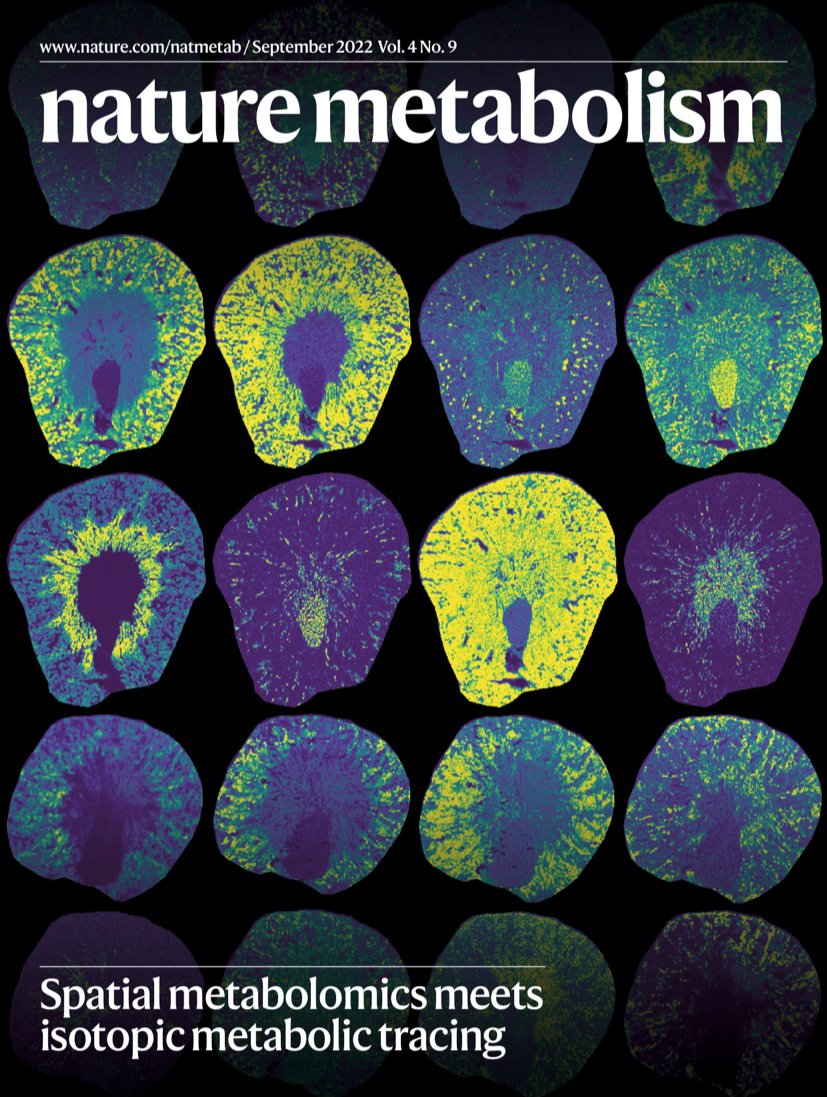 📌 SEPTEMBER ISSUE

Browse through our collection on best practices in metabolic research &amp; check out our primary research: #alcohol + cannabinoid toxicity, #obesity subtypes, kidney repair (our cover), ovarian cancer, liver &amp; adipose tissue #biology.

nature.com/natmetab/volum…