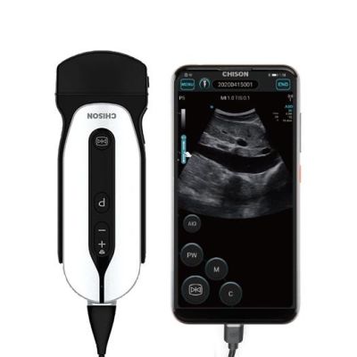 Pocket sized an ultrasound handheld device for #Tanzania from @chisonmedical @jmkfhq @MsdTanzania addressing point of care cardiology facilities #TanzaniaIkoTayari