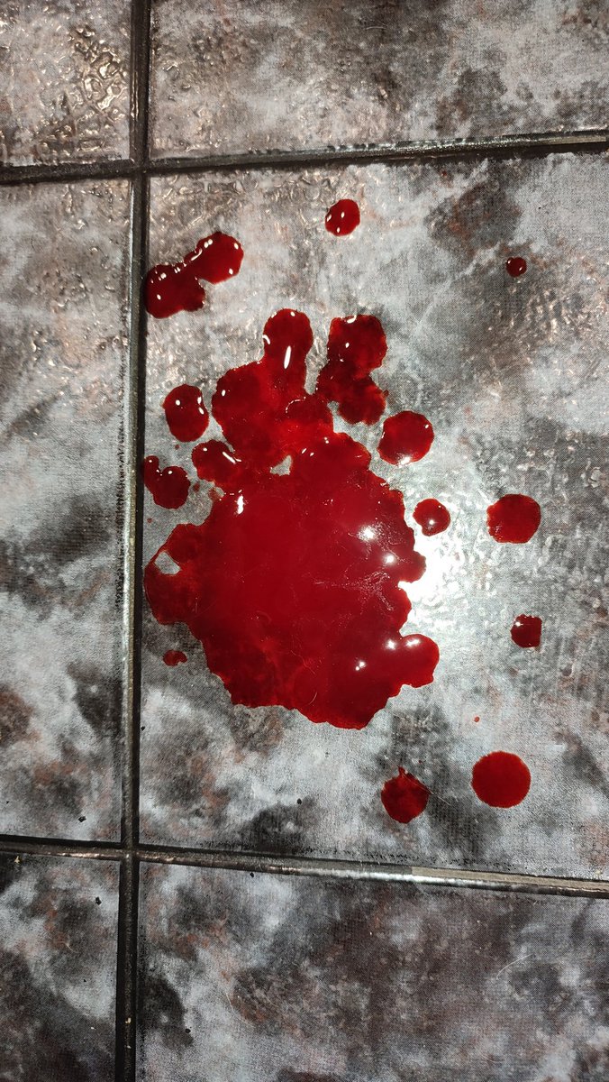 aancheto's tweet photo. #shtwt #sh #selfharm #tw #sfxmakeup #catscratches https://t.co/mMmnkarL0D