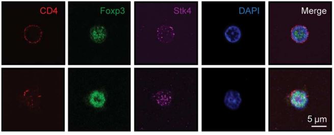 SciImmunology's tweet photo. Behavior of regulatory T (Treg) cells can be affected by the relationship between serine/threonine kinase 4 (Stk4) and transcription factor Foxp3. @harvardmed @BostonChildrens

https://t.co/NuoDnfZv8m https://t.co/7SCwmy67qQ