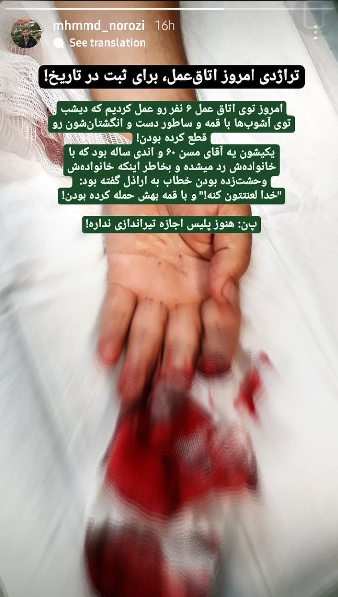 ali_kheibari's tweet photo. استوری از اتاق عمل

می‌بینید پلیس با چه وحشی‌هایی طرفه؟ https://t.co/BXGWkwFpD7