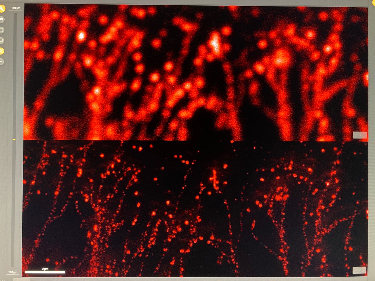 sukumar_swathi's tweet image. More fireworks 💥 for #FluorescenceFriday because I can’t get over how awesome @Abberior 635P is!