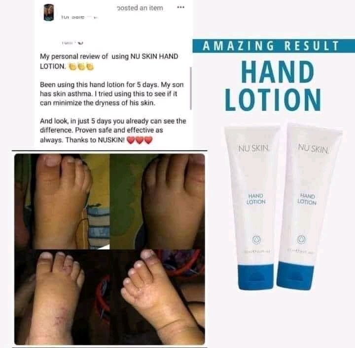 just_takami's tweet photo. Hand Lotion Testimonial‼️ Super effective kaya try nyo na din po lalo na kung ganito din nararanasan nyo or ng isa sa family nyo.
Super tipid po nito!💕
—
#Skincare #HandLotion #QuickAbsorbing #HandMoisturizing https://t.co/cASJdW8WEW