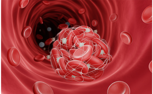 touchCARDIO's tweet photo. What does the  past, present and future of cancer-associated thrombosis management look like?

Read the full review here: https://t.co/e2ufrxthUl

#Cancer 
#Thrombosis
#CancerRelated
#MedicalStudy
#DVT
#DeepVeinThrombosis https://t.co/AgSw5VJlTO