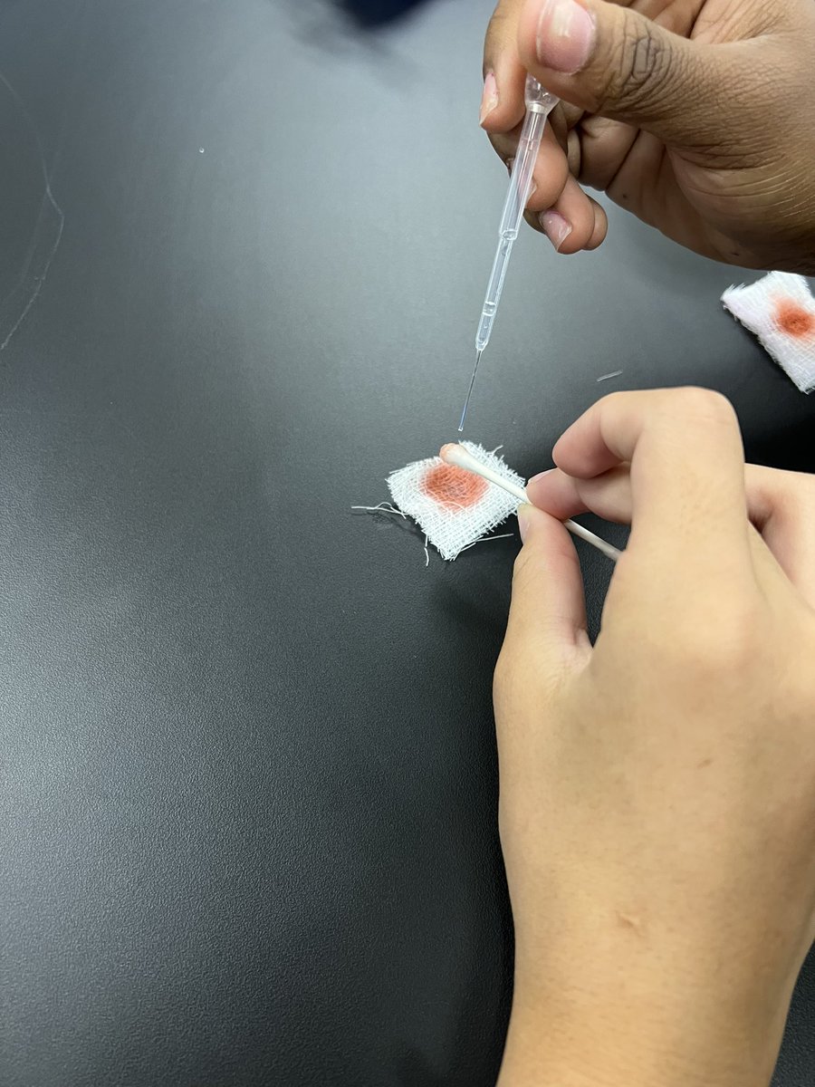 BrainyBio_Bunch's tweet photo. @WarhillHigh @PLTWorg Ss answered whether it was was really blood with an @edvotek blood typing kit.  Ss performed a Kastle-Meyer test in class.   (This is all fake blood!) https://t.co/tCYyIpqbye
