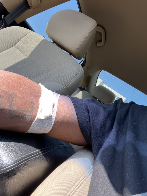 Talent tested ✅ @TalentTesting https://t.co/v8fTngHkoR<a class="tags" target="_blank" title="On Twitter" href="/?out=eyJ0eXAiOiJKV1QiLCJhbGciOiJIUzUxMiJ9.eyJpYXQiOjE3MjQ2Mzk3NzgsImlzcyI6InR3cG9ybnN0YXJzLmNvbSIsIm5iZiI6MTcyNDYzOTc3OCwiZXhwIjoxNzU2MTc1Nzc4LCJyZWRpcmVjdF91cmwiOiJodHRwczovL3R3aXR0ZXIuY29tL1RhbGVudFRlc3RpbmcifQ.A-OWLxJa3CsUv39Nv8feFE_8mZF9seLScnzrnbIem54XwXIzIQmc-NiB7YnB-twfDrsn1I3LzmsFs-mlYUOVtQ">@TalentTesting</a><a href="/tag/mytwitteranniversary"class="tags"><span>#mytwitteranniversary</span></a>