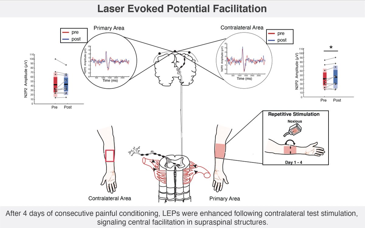 New paper 🚨 

Supraspinal facilitation to repetitive painful stimulation: A laser evoked potential study 🧠pubmed.ncbi.nlm.nih.gov/36130178/ 
Thanks to all my co-authors (non-twitter beings) and to <a href="/JNeurophysiol/">JNP</a> 
  Really enjoyed making my first graphical abstract🎨