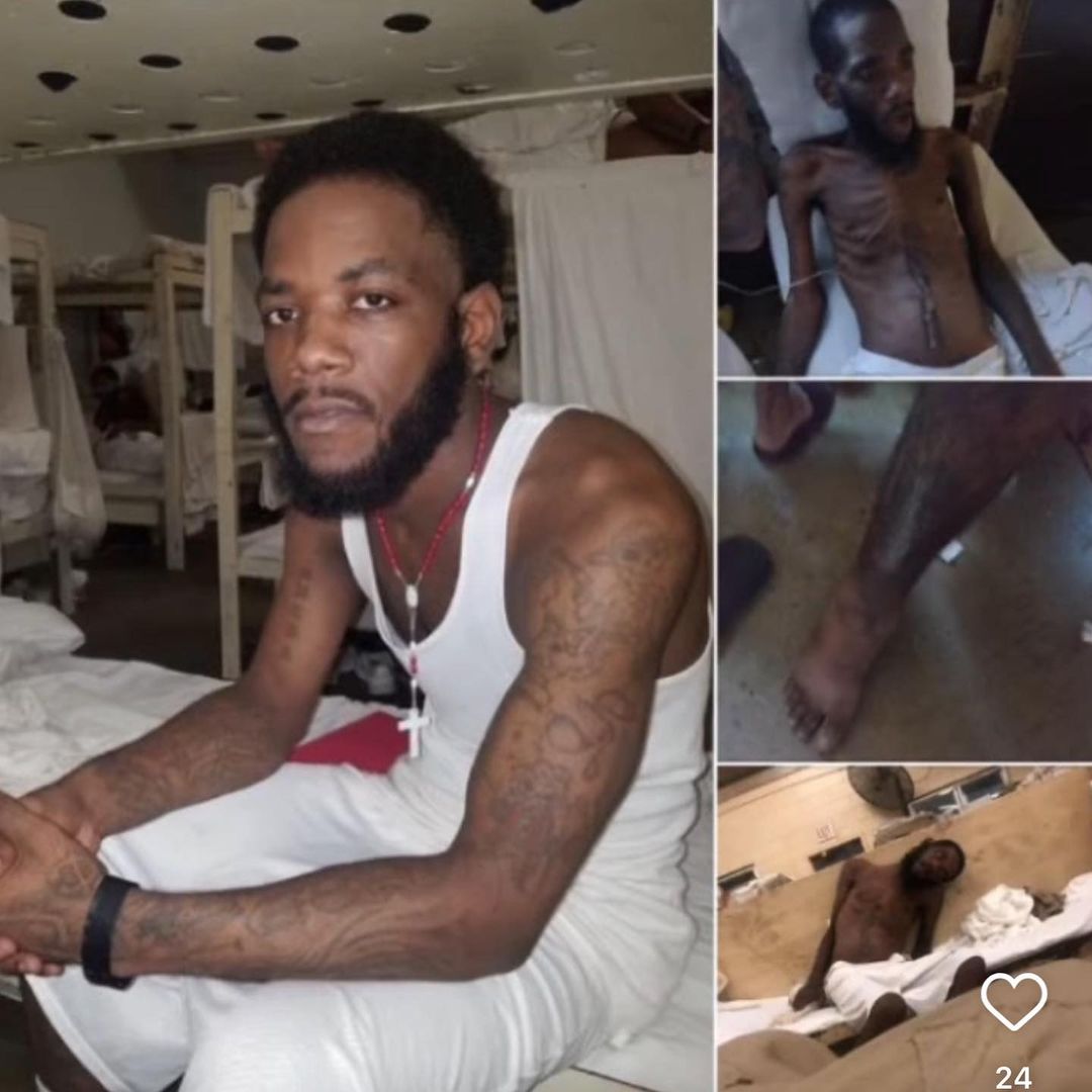 ⚠️ Graphic Images ⚠️ 
Alabama inmate Kastellio Vaughan needs serious medical attention NOW! His family — who were repeatedly hung up on by the Elmore Correctional Facility when inquiring about his malnourished appearance &amp; welfare — shouldn't have to beg for answers!