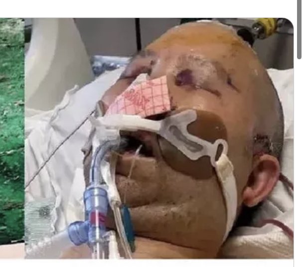 Marybel González (@marybelgnews) on Twitter photo BREAKING: Jin Lew’s son tells me CPD has someone custody in connection to his dad’s brutal beating and carjacking. Lew was heading home after visiting his son in the South Loop on the night of April 6, when he was attacked in Chinatown. <a href="/cbschicago/">CBS Chicago</a> cbsnews.com/chicago/news/c… BREAKING: Jin Lew’s son tells me CPD has someone custody in connection to his dad’s brutal beating and carjacking. Lew was heading home after visiting his son in the South Loop on the night of April 6, when he was attacked in Chinatown. <a href="/cbschicago/">CBS Chicago</a> cbsnews.com/chicago/news/c…