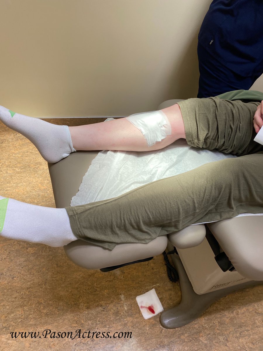 PasonActress's tweet photo. #BasalCellSkinCancer #MOHsSurgery on right shin #SkinCancer #FairSkin #NaturalRedheads #Redheads #Gingers #Health #SkinCare Great MOHs Surgeon Dr. David Beynet! Thank u! If something doesn't look normal or isn't healing go to ur Dr. &amp; get it checked! #Pason #PasonActress https://t.co/ewoS7u4G1q