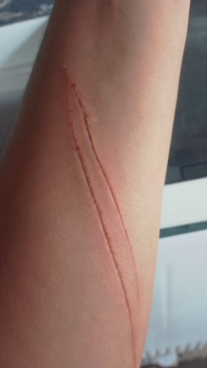 Veronica251189's tweet photo. 😭😭 q ago me duele mucho??? https://t.co/Hh09Rj66Gi