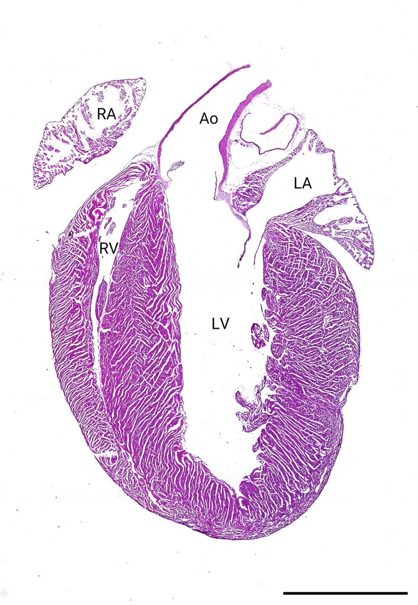 Brigham and Womenâs CICS (@cicsnews) on Twitter photo CICS features the Art of Science: Mesmerizing anatomy of a whole mouse heart section with aortic and mitral valve. Artist: <a href="/JSchmalzridt/">Jonathan Schmalzridt</a> and Katey P!
Ao, aorta; LA, left atrium; LV, left ventricle; RA, right atrium; RV, right ventricle; H&E, frozen section, 7”m. Scale bar, 2mm. CICS features the Art of Science: Mesmerizing anatomy of a whole mouse heart section with aortic and mitral valve. Artist: <a href="/JSchmalzridt/">Jonathan Schmalzridt</a> and Katey P!
Ao, aorta; LA, left atrium; LV, left ventricle; RA, right atrium; RV, right ventricle; H&E, frozen section, 7”m. Scale bar, 2mm.