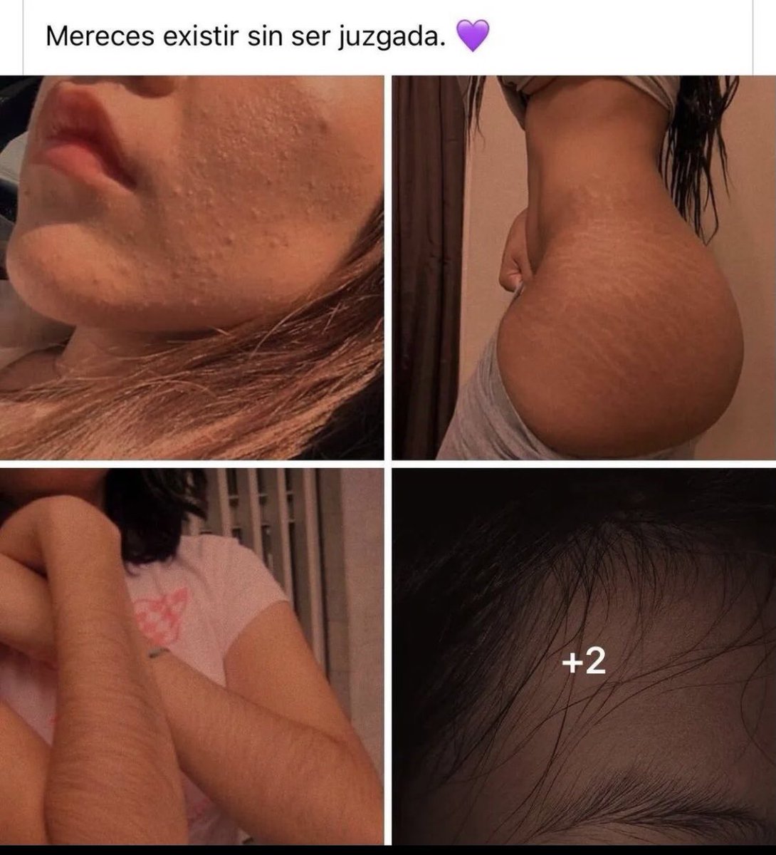 loretorres0704's tweet photo. La imperfección es la verdadera belleza 🥰 https://t.co/04NTm7QMJe