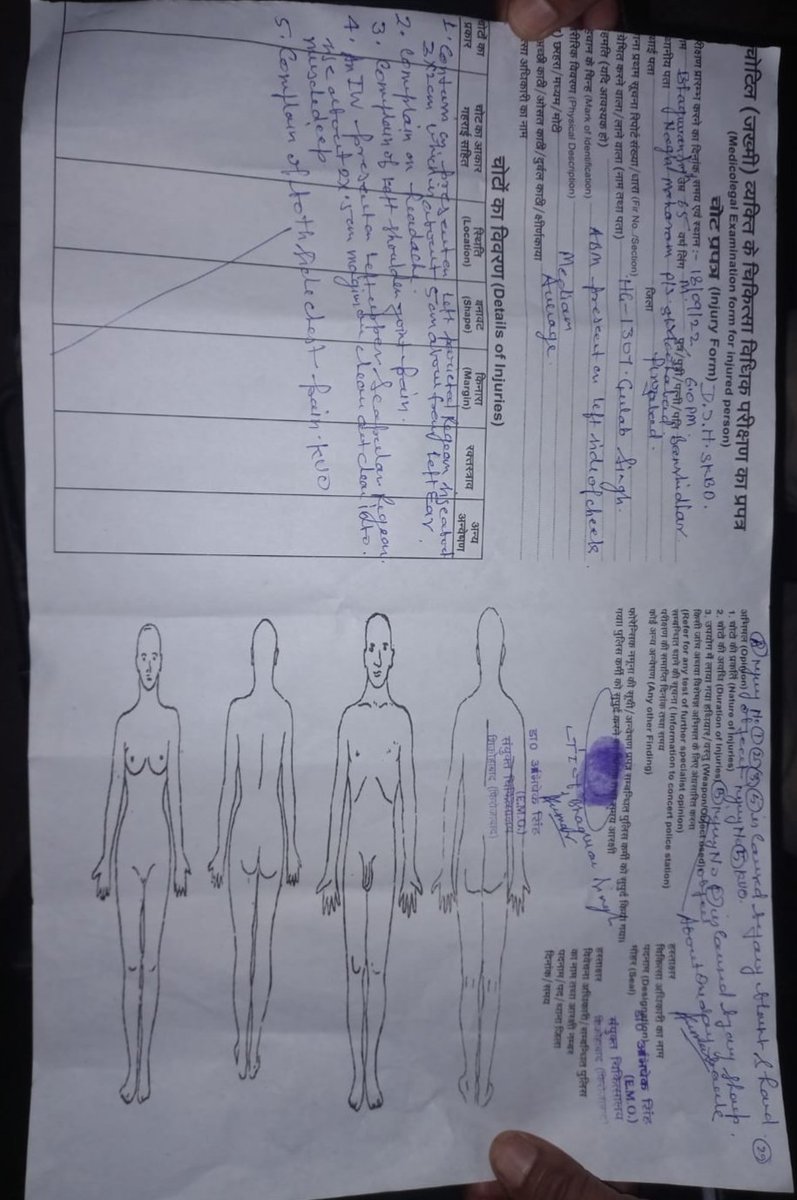 JayaramJerem's tweet photo. @adgzoneagra प्रार्थी भगवान सिंह नगला महाराज थाना शिकोहाबाद जिला फिरोजाबाद 17 9 2022 एक्सीडेंट कर दिया दबंग लोगों ने थाने में तहरीर दी फिर भी पुलिस ने दबंगों के खिलाफ कोई भी आप आई आर दर्ज नहीं की पुलिस और दबंगों की मिलीभगत निवेदन है की एफ आई आर दर्ज की जाए आप की महान कृपा होगी https://t.co/cwglnupAhH