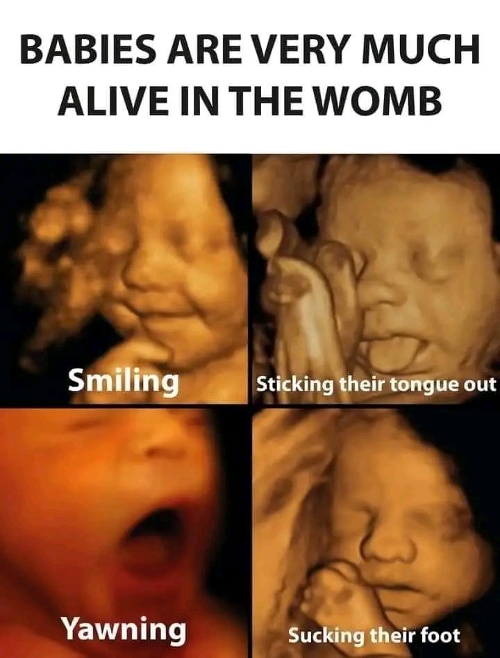 AKinderSociety's tweet photo. @randall_rising @JimAllister Biologically, scientifically and genetically 2 humans can only conceive another human (FACT) who dies in an abortion (FACT). Surely we can do better as a society, eg a package of #resources, but #abortion just cheaper?!! :-(
#EnoughViolence
#ResourcesInstead
#WomenDeserveBetter https://t.co/2zJ6rTXtmi