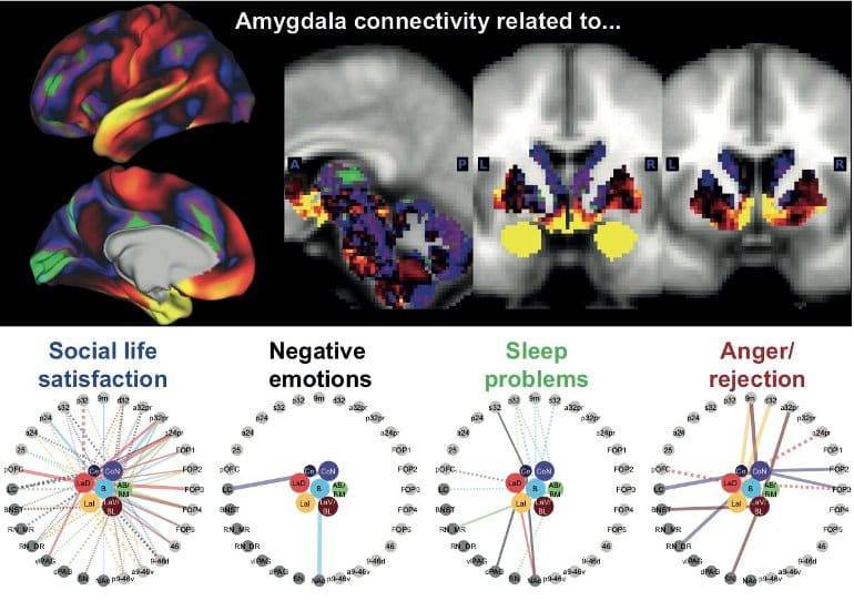 Metavilli's tweet photo. The brain connections that mattered most for discerning whether an individual was struggling with sleep problems, for example, looked very different from those that carried information about their social well-being. Credit: University of Oxford https://t.co/UqvI1VQyvV