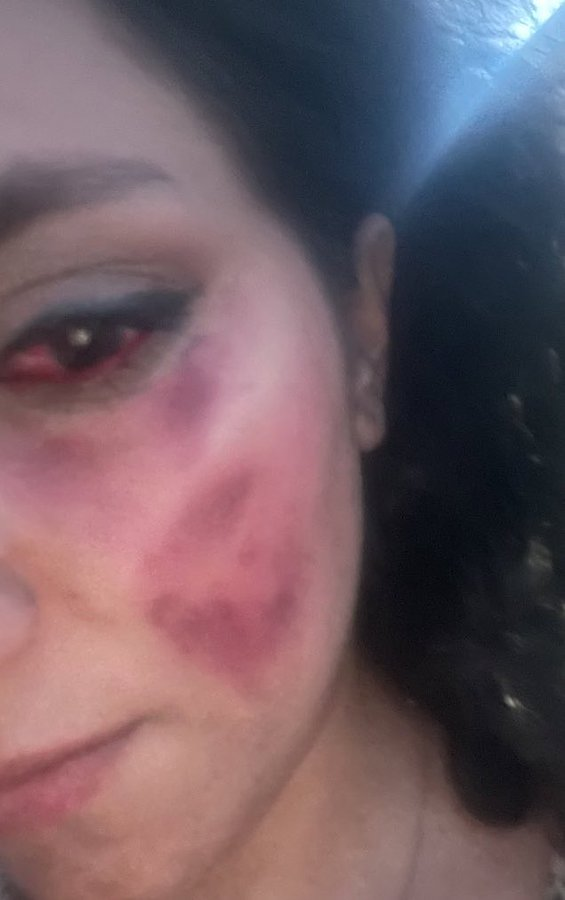 HodaHZN's tweet photo. هرچه تبر زدی مرا زخم نشد جوانه شد #OpIran  #مهسا_امینی 
#MahsaAmini  #OpIrani 
The picture below shows what happen in Iranian protest.
Unfortunately this is my first tweet. https://t.co/3tLs0XO7I3